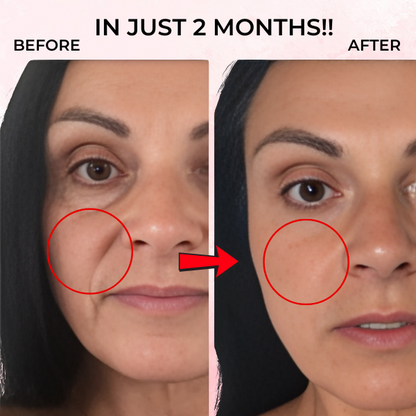 BIO COLLAGEN - Korean Skincare Mask
